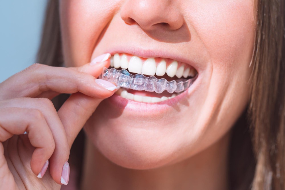 Invisalign in Norfolk